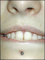 piercing